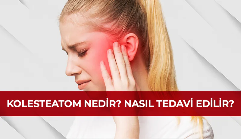 Kolesteatom nedir nasıl tedavi edilir